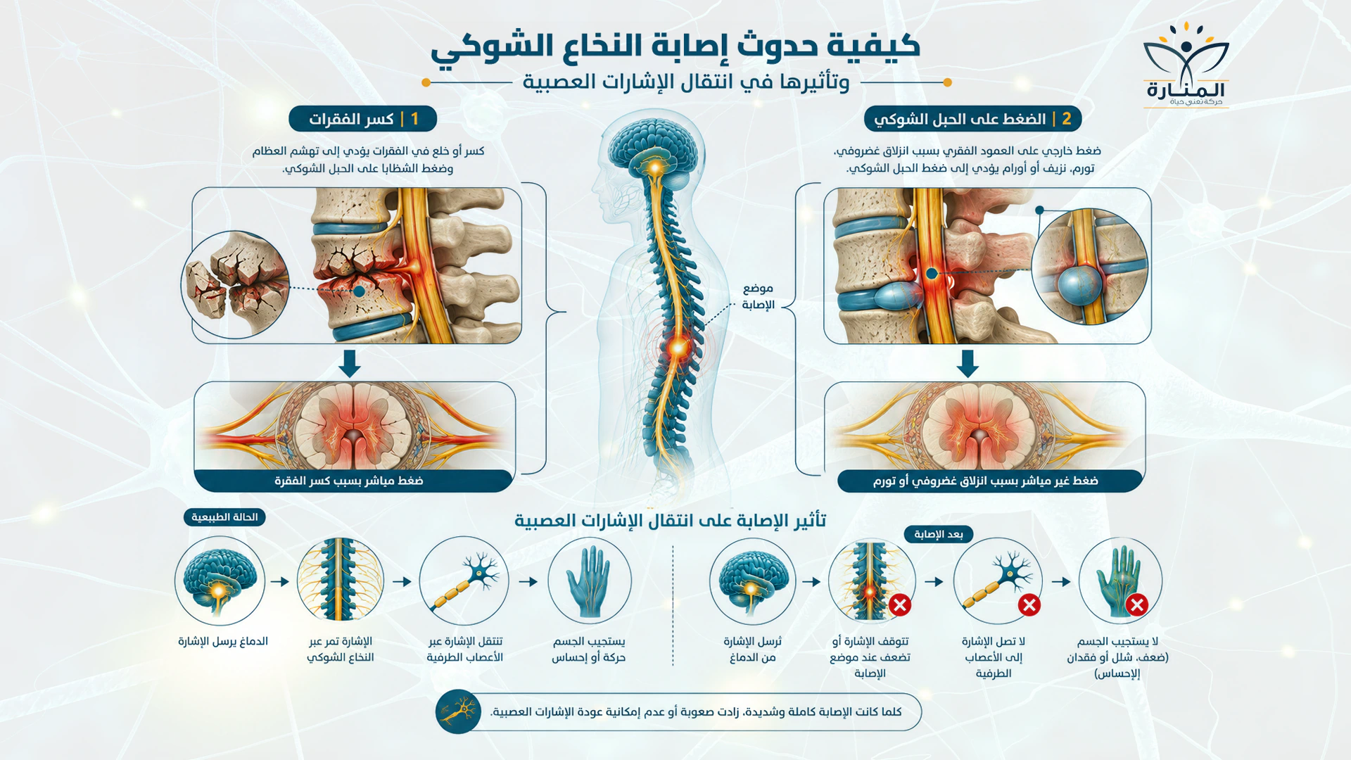 كيفية حدوث إصابة النخاع الشوكي وتأثيرها في انتقال الإشارات العصبية